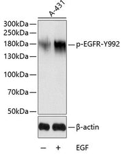 Phospho-EGFR-Y992 Rabbit pAb