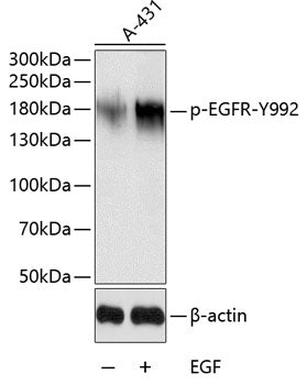 Phospho-EGFR-Y992 Rabbit pAb