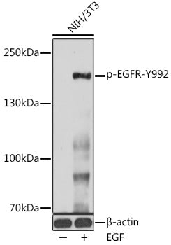 Phospho-EGFR-Y992 Rabbit pAb