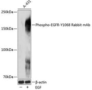 Phospho-EGFR-Y1068 Rabbit mAb
