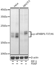 Phospho-eIF4EBP1-T37/46 Rabbit pAb