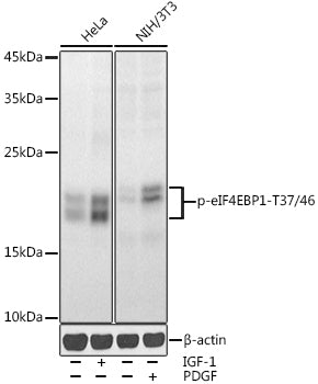 Phospho-eIF4EBP1-T37/46 Rabbit pAb