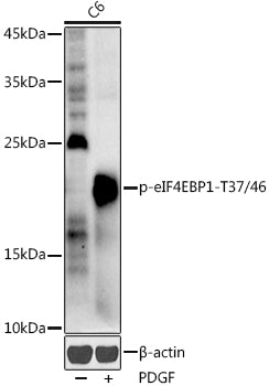 Phospho-eIF4EBP1-T37/46 Rabbit pAb
