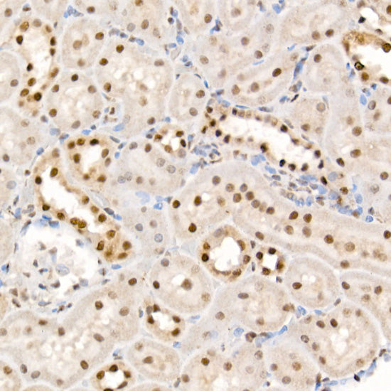 Phospho-eIF4EBP1-T37/46 Rabbit pAb