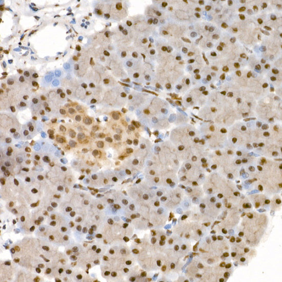 Phospho-eIF4EBP1-T37/46 Rabbit pAb
