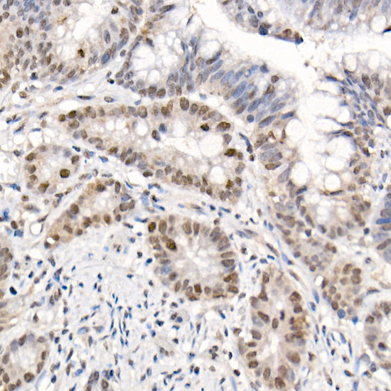 Phospho-eIF4EBP1-T70 Rabbit pAb