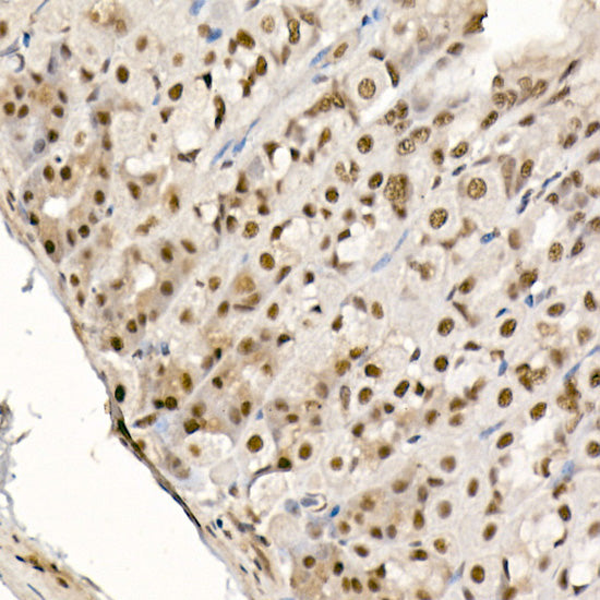 Phospho-eIF4EBP1-T70 Rabbit pAb