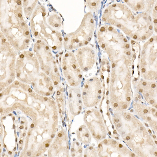 Phospho-eIF4EBP1-T70 Rabbit pAb