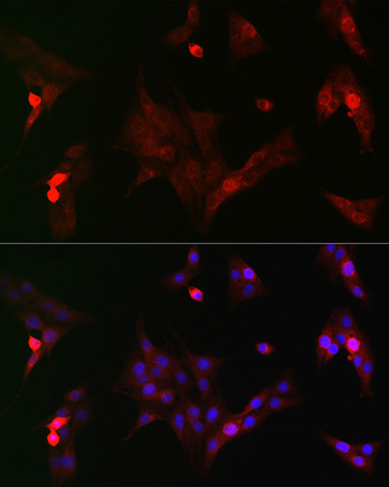Phospho-GSK3β-S9 Rabbit pAb