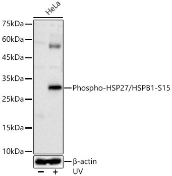 Phospho-HSP27/HSPB1-S15 Rabbit pAb