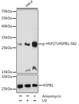 Phospho-HSP27/HSPB1-S82 Rabbit pAb