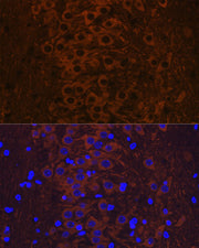 Phospho-Tau-T231 Rabbit mAb