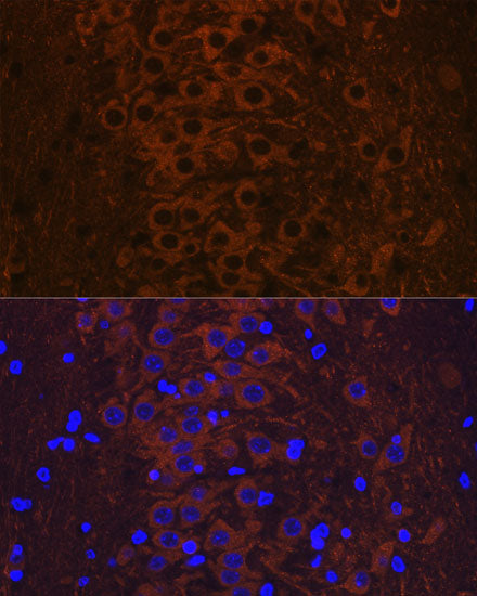 Phospho-Tau-T231 Rabbit mAb