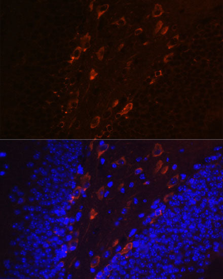 Phospho-Tau-T231 Rabbit mAb