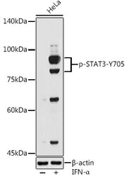 Phospho-STAT3-Y705 Rabbit pAb
