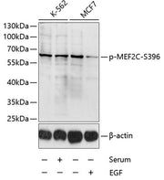 Phospho-MEF2C-S396 Rabbit pAb
