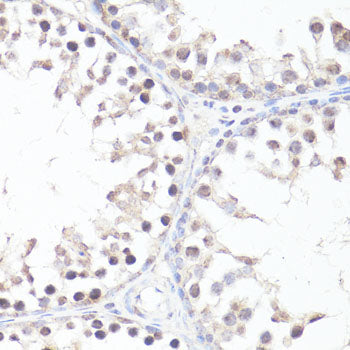 Phospho-c-Myc-T58 Rabbit pAb
