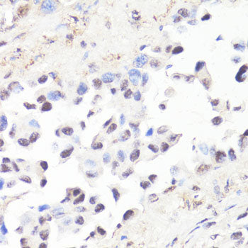 Phospho-c-Myc-T58 Rabbit pAb