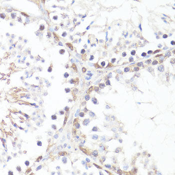 Phospho-c-Myc-T58 Rabbit pAb