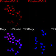 Phospho-p53-S15 Rabbit pAb