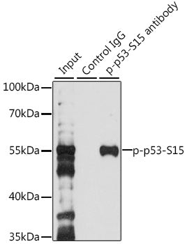 Phospho-p53-S15 Rabbit pAb