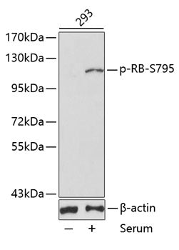 Phospho-RB-S795 Rabbit pAb