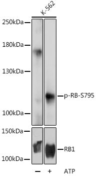 Phospho-RB-S795 Rabbit pAb