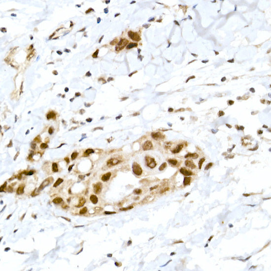 Phospho-RB-S795 Rabbit pAb