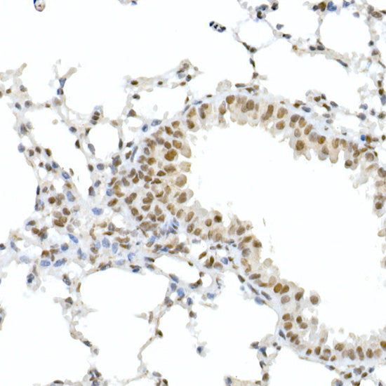 Phospho-RB-S795 Rabbit pAb