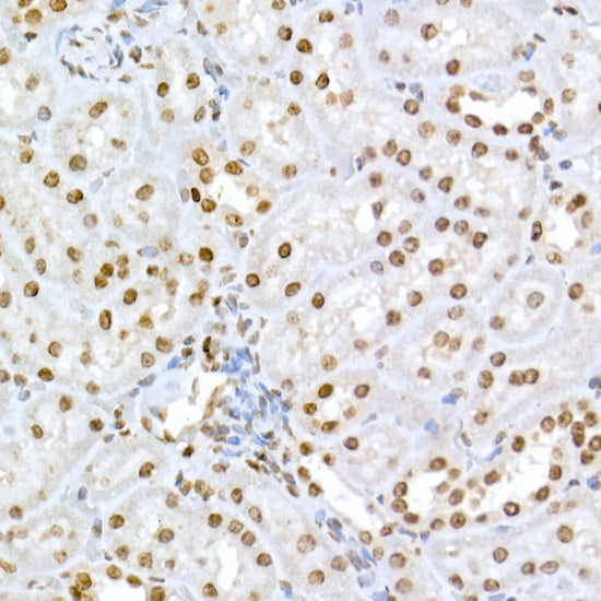 Phospho-RB-S795 Rabbit pAb
