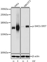 Phospho-SMC1-S957 Rabbit pAb