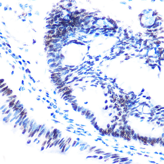Phospho-SMC1-S957 Rabbit pAb