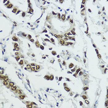 Phospho-Histone H3-T11 Rabbit pAb