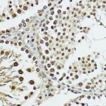 Phospho-Histone H3-T11 Rabbit pAb