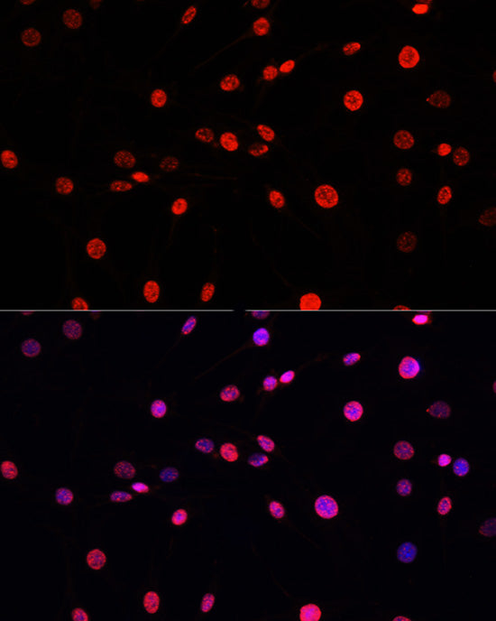 Phospho-Histone H3-T11 Rabbit pAb