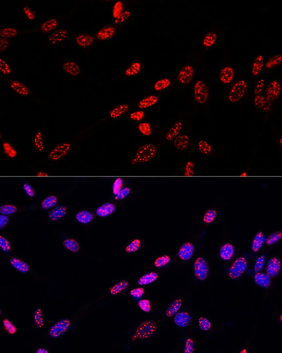 Phospho-Histone H3-T11 Rabbit pAb