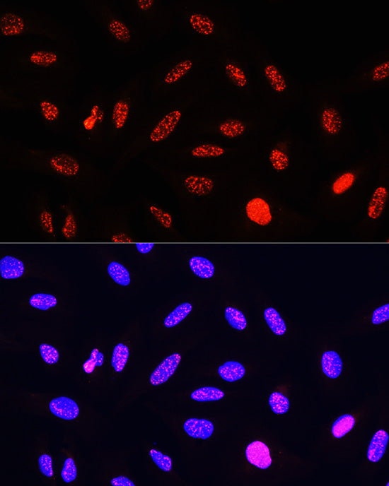 Phospho-Histone H3-T11 Rabbit pAb