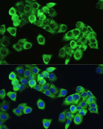 Phospho-mTOR-S2448 Rabbit pAb