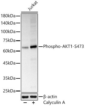 Phospho-AKT1-S473 Rabbit pAb