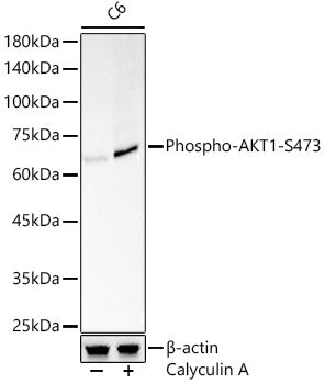 Phospho-AKT1-S473 Rabbit pAb