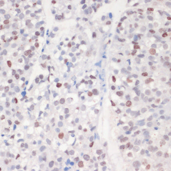 Phospho-Histone H2AX-S139 Rabbit pAb