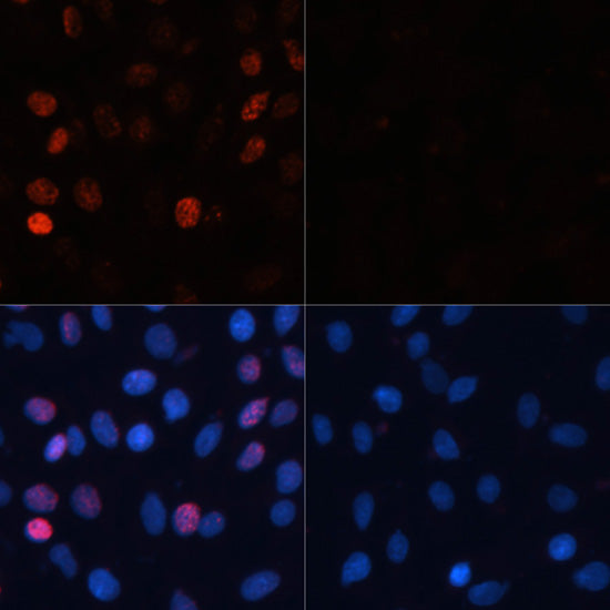 Phospho-Histone H2AX-S139 Rabbit pAb