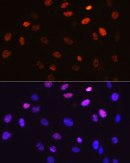 Phospho-c-Jun-S63 Rabbit mAb