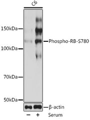 Phospho-RB-S780 Rabbit mAb