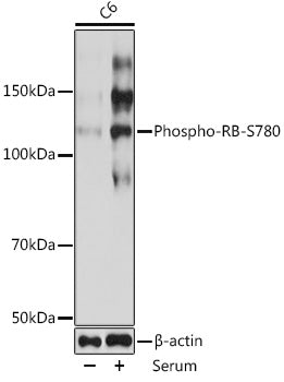 Phospho-RB-S780 Rabbit mAb