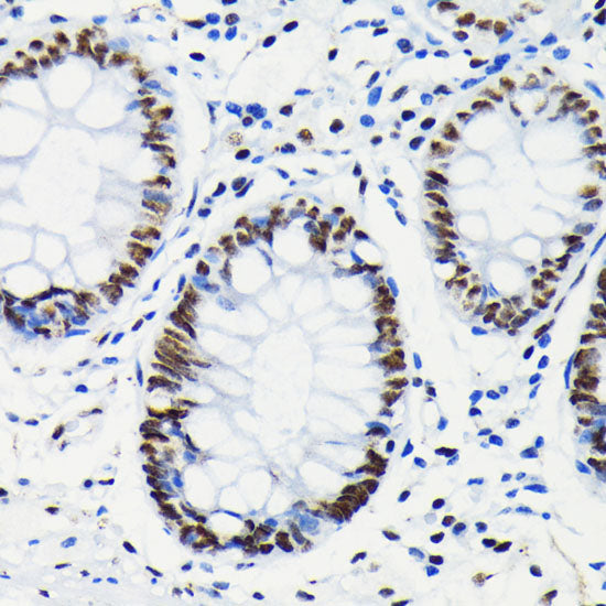 Phospho-RB-S780 Rabbit mAb