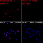 Phospho-NF-kB p65/RelA-S536 Rabbit pAb