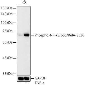 Phospho-NF-kB p65/RelA-S536 Rabbit pAb