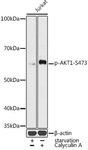 Phospho-AKT1-S473 Rabbit pAb