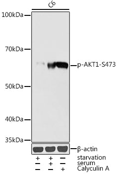Phospho-AKT1-S473 Rabbit pAb